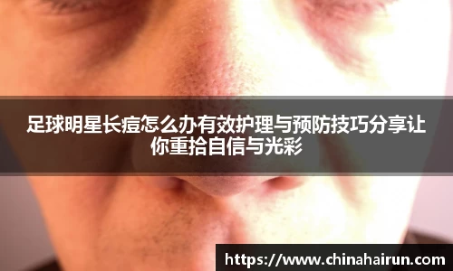 足球明星长痘怎么办有效护理与预防技巧分享让你重拾自信与光彩